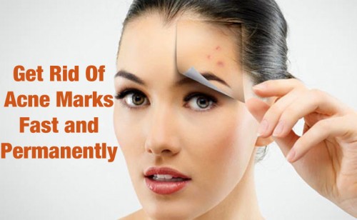 Skin Problems